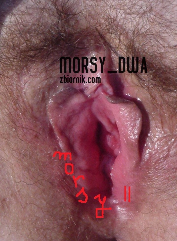 Różyczka - Morsy_dwa