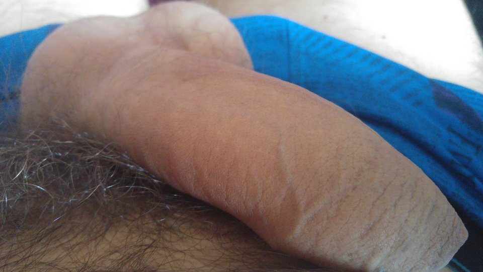 20160730_101703.jpg - Promien3