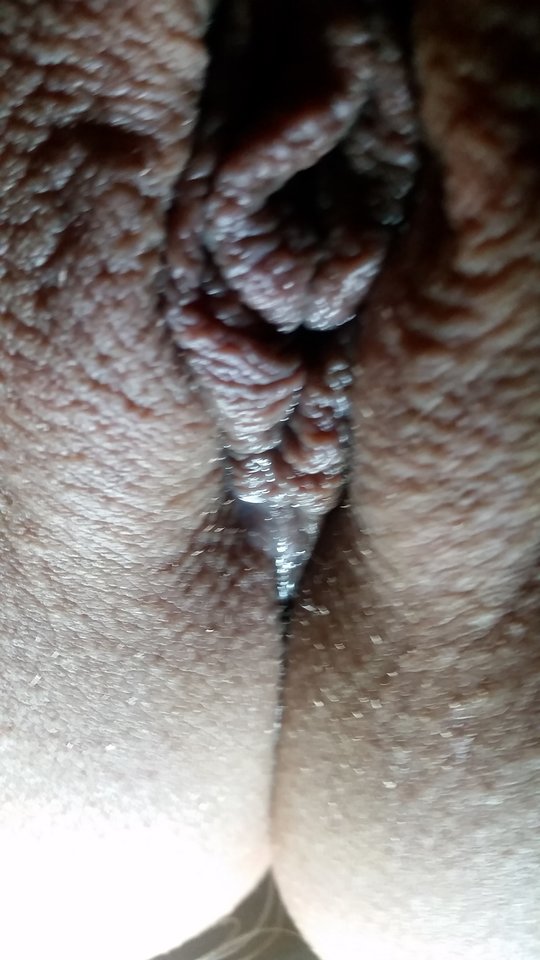 zalana cipka - Endofinki