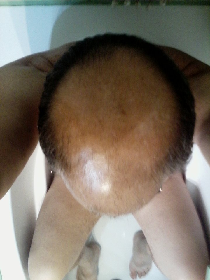 IMG_20160904_064847.jpg - matuzalem000