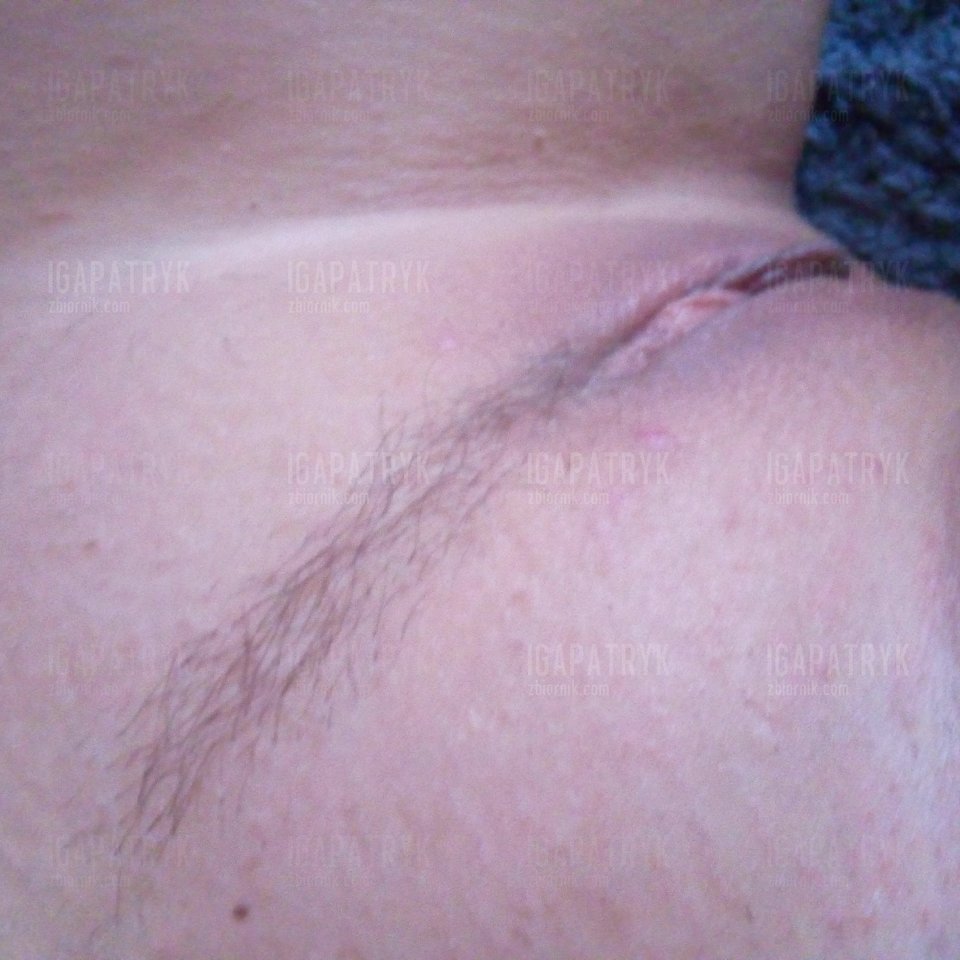 20160904_103021.jpg - igapatryk