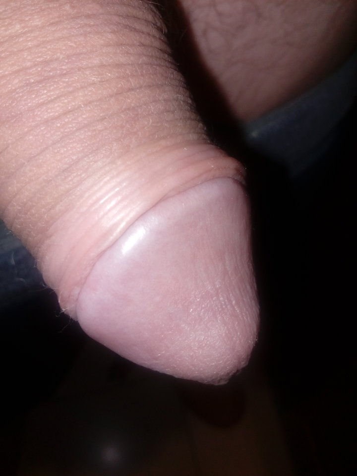 IMG_20170122_091501.jpg - matuzalem000