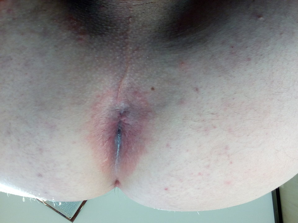 IMG_20170215_103354.jpg - tessalinek1