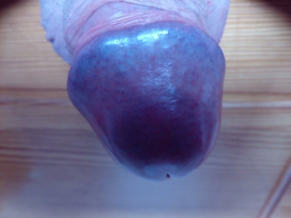 IMG_20170301_110139.jpg - tessalinek1