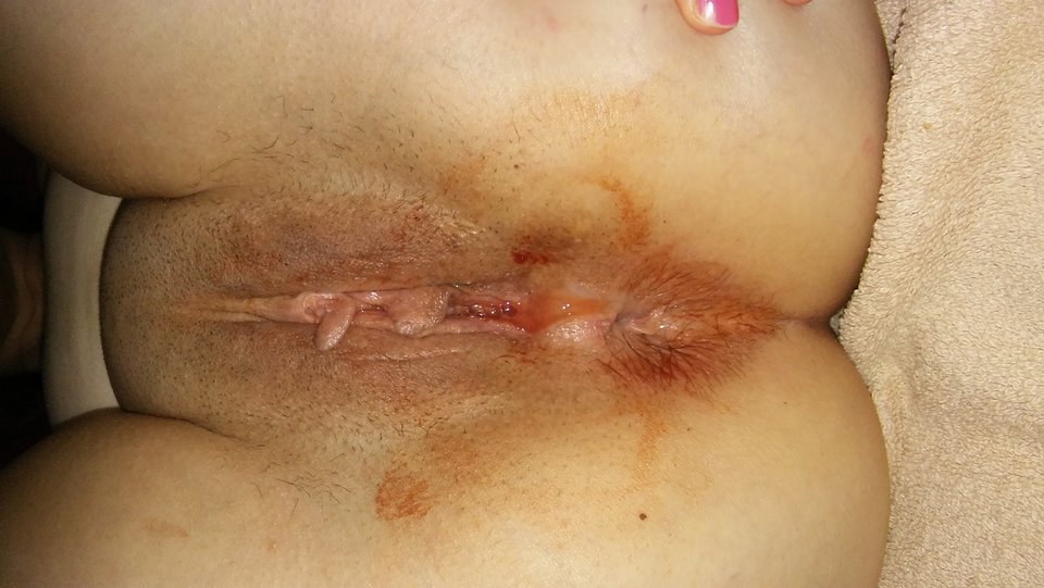 20170315_102754.jpg - Parka3031