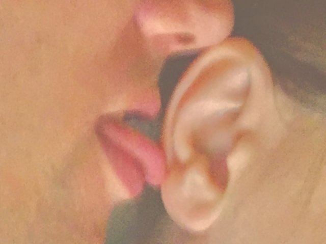 ostra_para