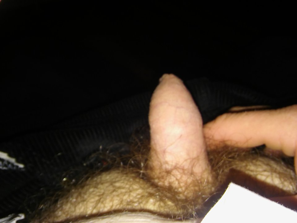 20170607_225249.jpg - mikropenis