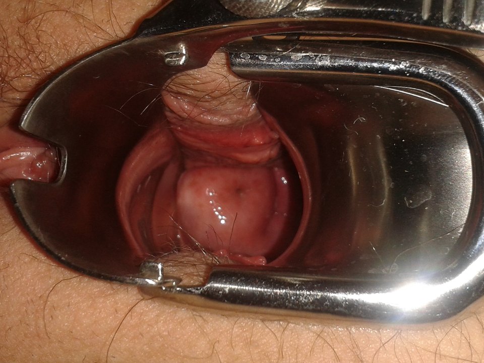 20170708_232142.jpg - lata70