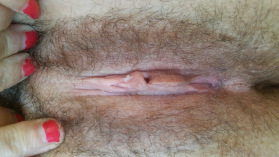 20170724_163942.jpg - Parka3031