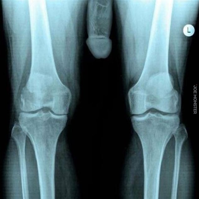 IMG_3633.JPG - Johnmalgo