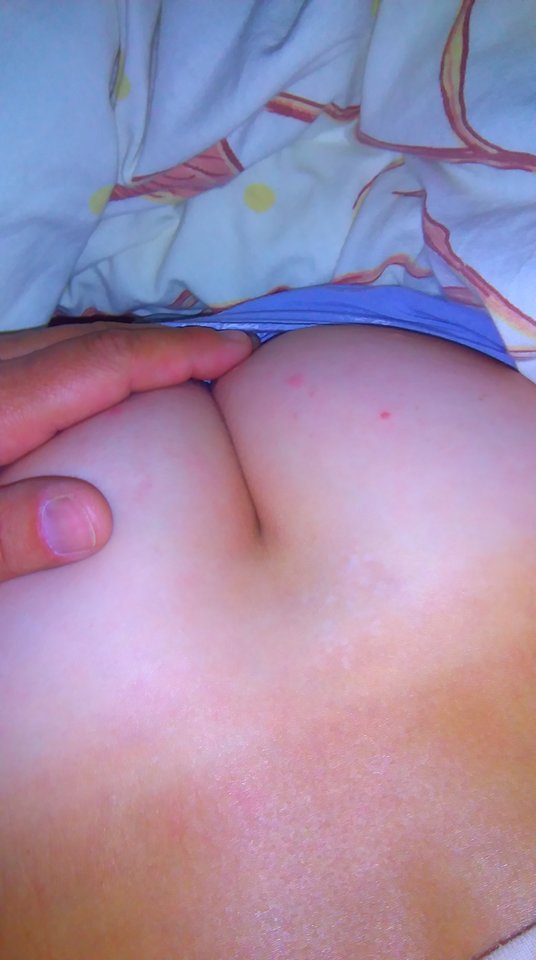 IMAG1351.jpg - onilubiacyto