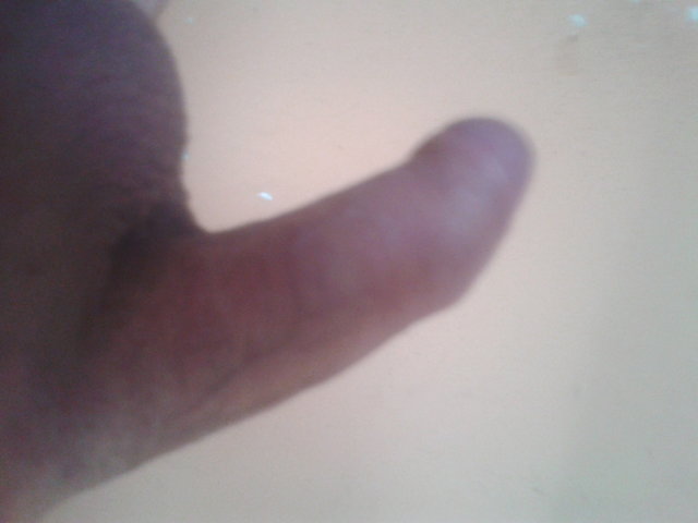 yuptus