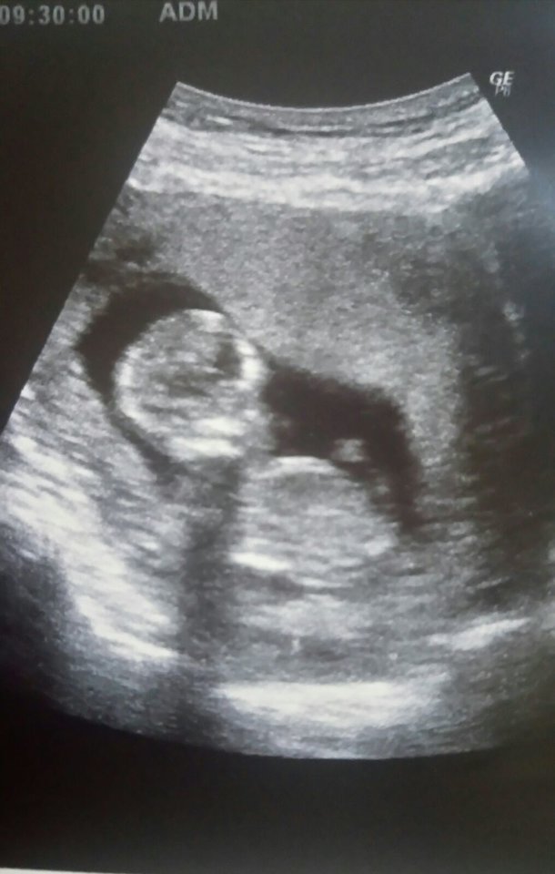 IMG-20170816-WA0004.jpg - OnOna8687