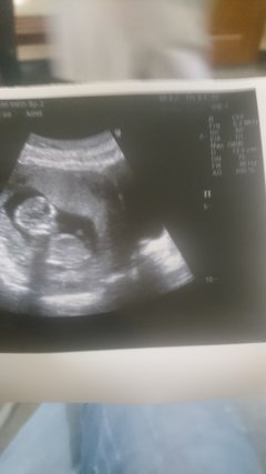 Nasze maleństwo w 12tygodniu i 3dniu :)