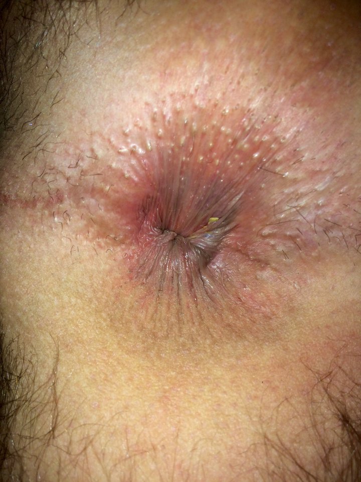 IMG_2657.JPG - bisexja