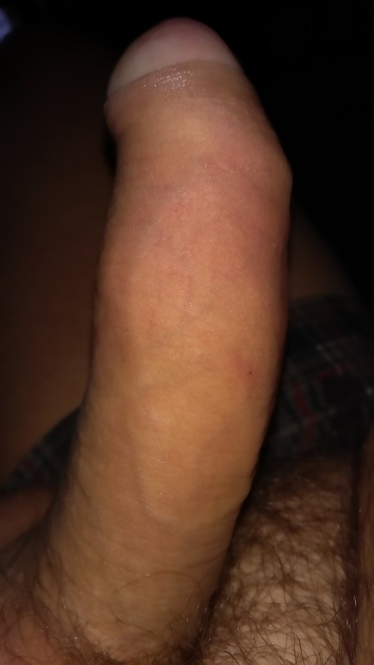 IMG_20171118_195052.jpg - Gumimi