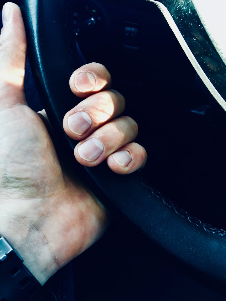 A9526725-1BF4-48CC-8CAA-754303A1A5C3.jpeg - Kosciuszko2000