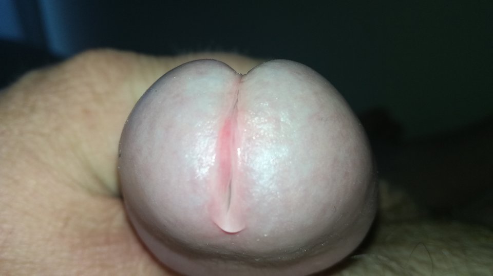 IMG_20180404_083340.jpg - setegasum