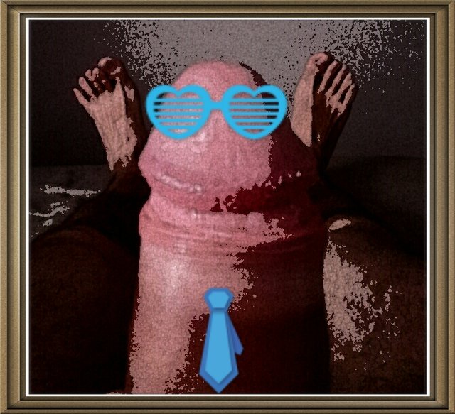151