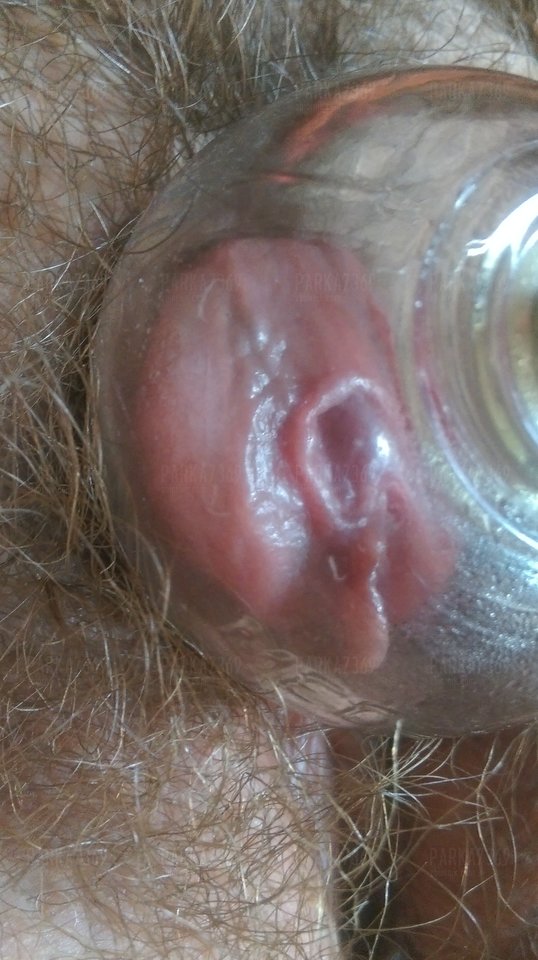 IMAG0817.jpg - parka7369