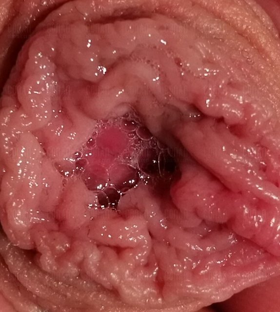 IMG_20180529_225925.jpg - C0nan