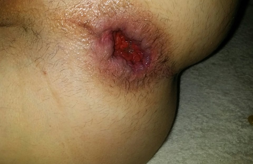 20180607_235957.jpg - edun