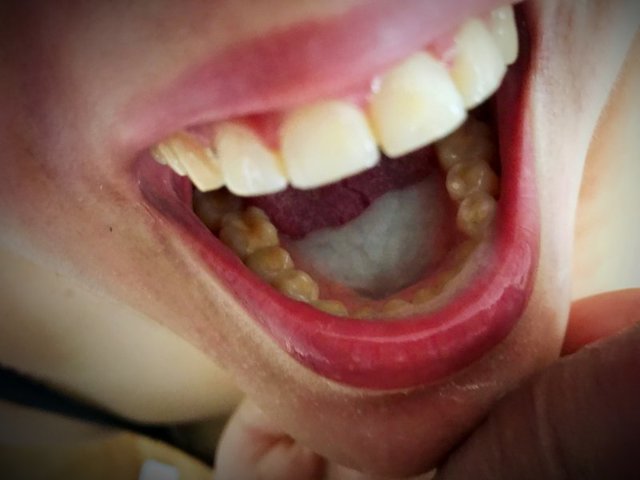 połyk - perversbialystok