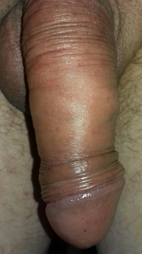 20180703_081811~2.jpg - bolus36