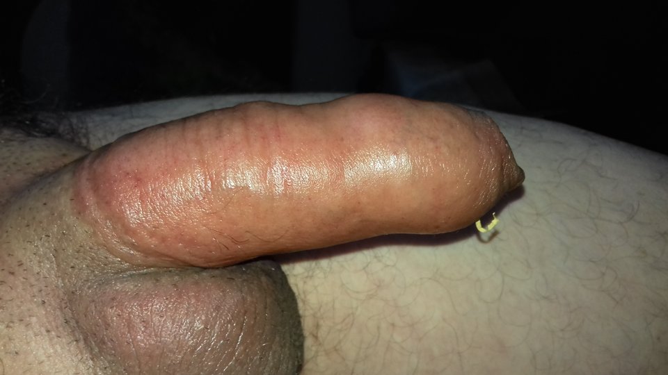 20180703_081729.jpg - bolus36