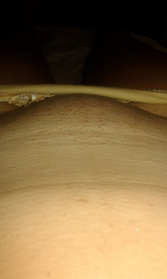 20180801_222432.jpg - kusy13