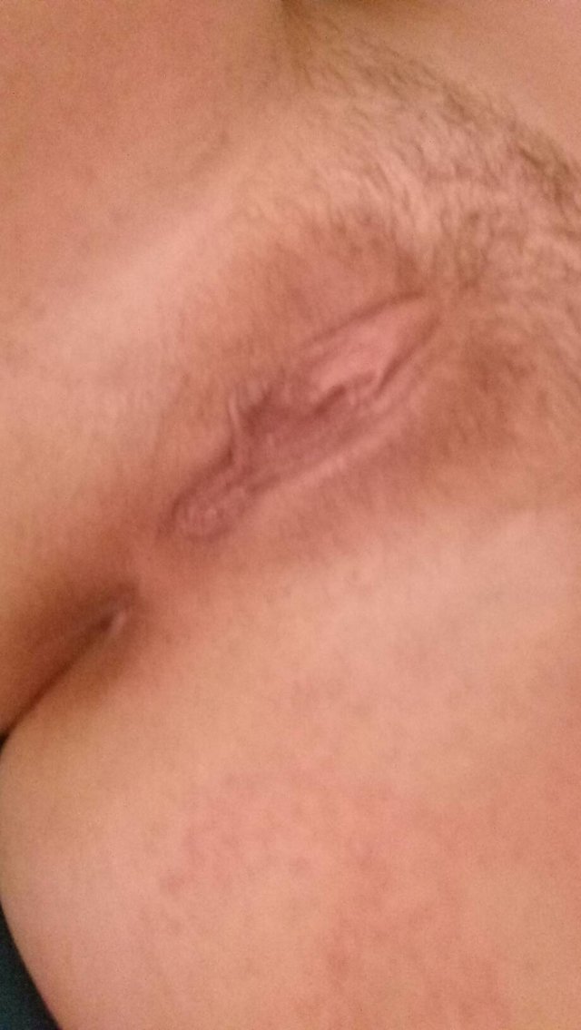 mlodycum