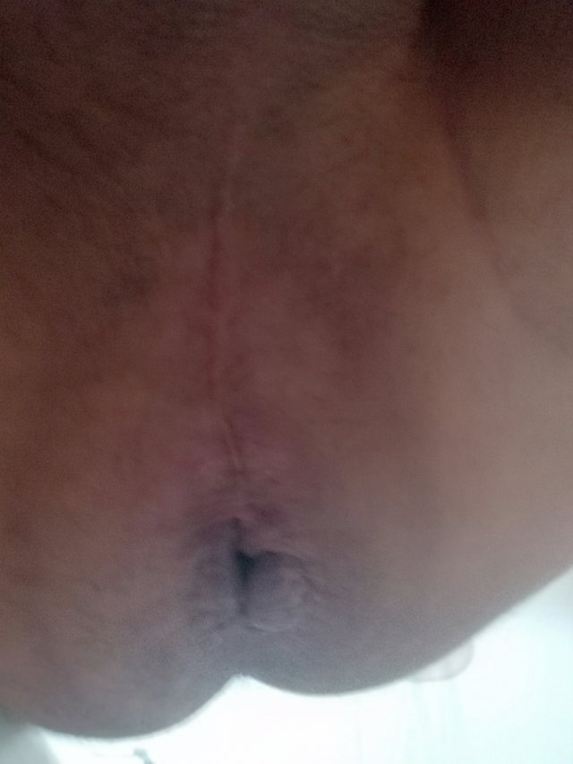 misiekx2
