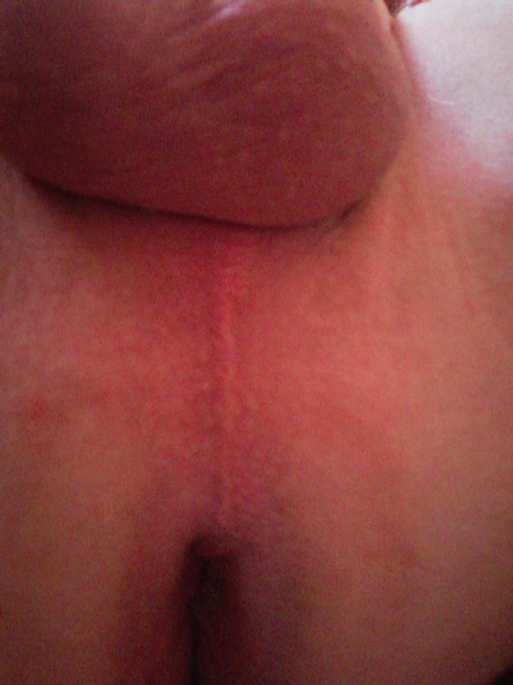 2018-08-01 11.50.47.jpg - gladki78