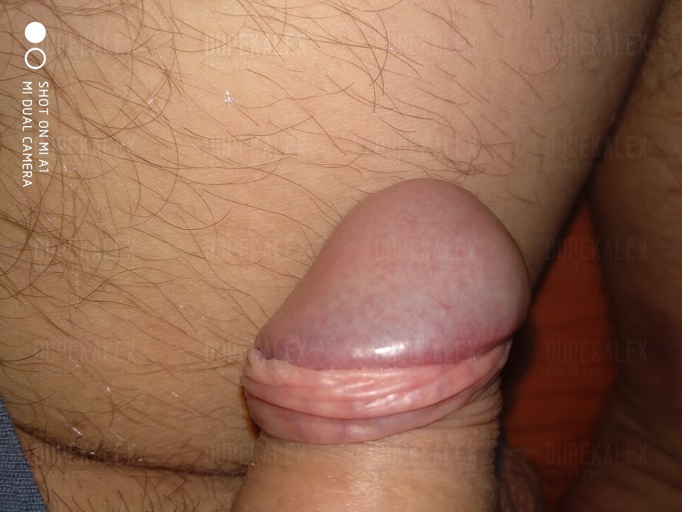 IMG_20181207_214340.jpg - dupekalex