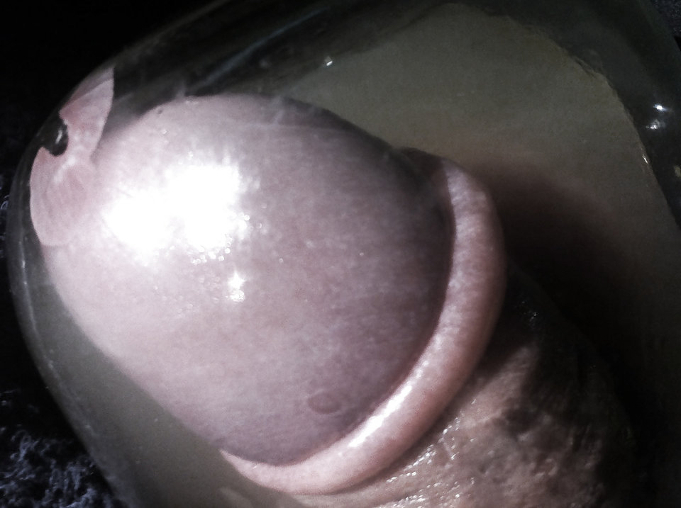 401_1000.jpg - RATCVAC