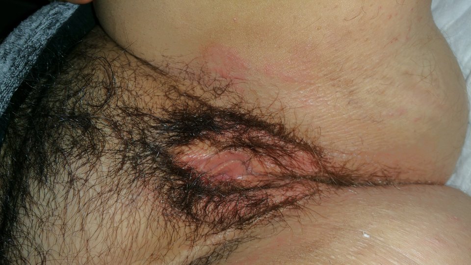 20181228_193551.jpg - abcpara