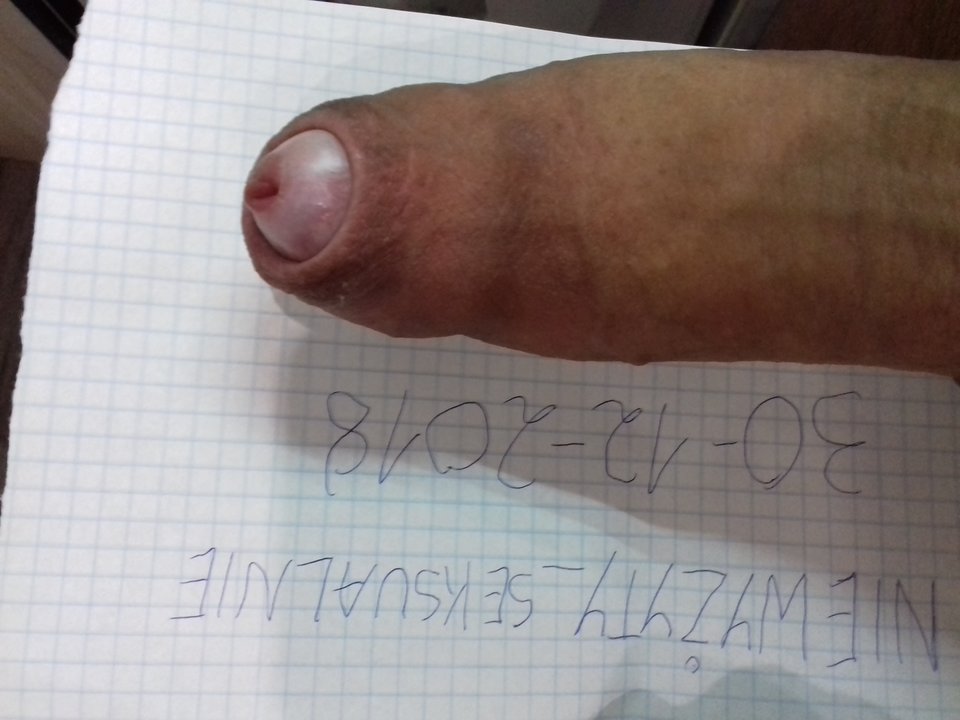 20181230_143438.jpg - niewyzyty_seksualnie