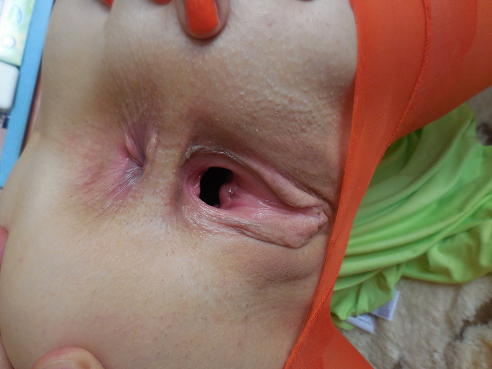 DSCN1000.JPG - ZakochanaParka10