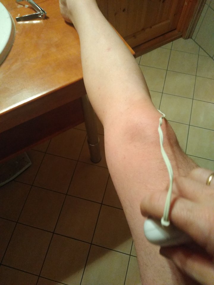 15829288926977138016134187736555.jpg - Palciusia