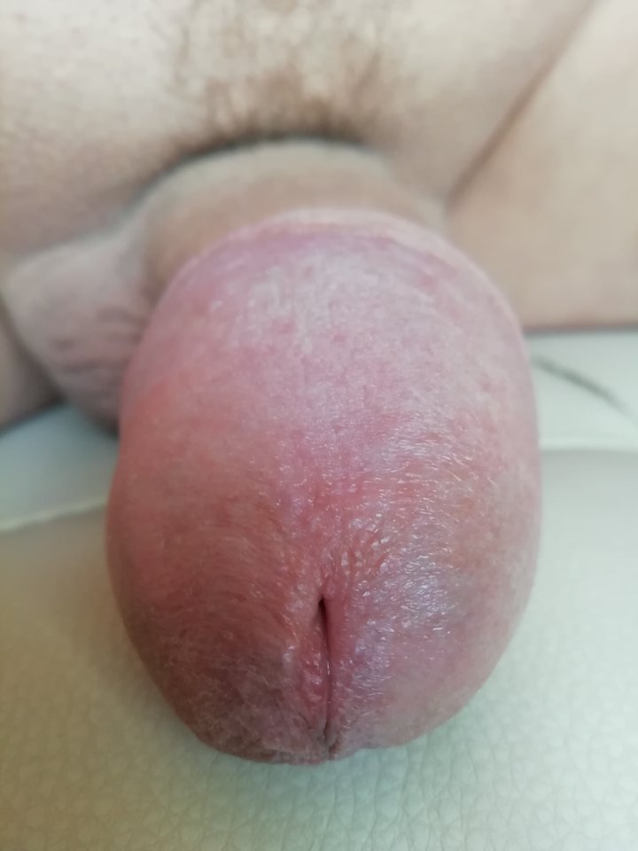 IMG_20200316_072202.jpg - wirus101