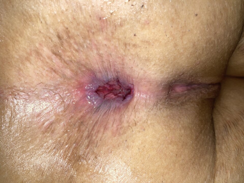 6F35758C-3909-4FCF-92B0-5F457B601225.jpeg - Nienormalny2019